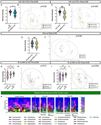 Gut microbiota analyses of cutaneous T-cell lymphoma patients undergoing narrowband ultraviolet B therapy reveal alterations associated with disease treatment